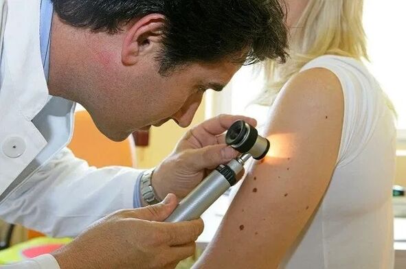 papillómák diagnosztizálása